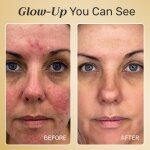 Omnilux Red Light Face Mask image