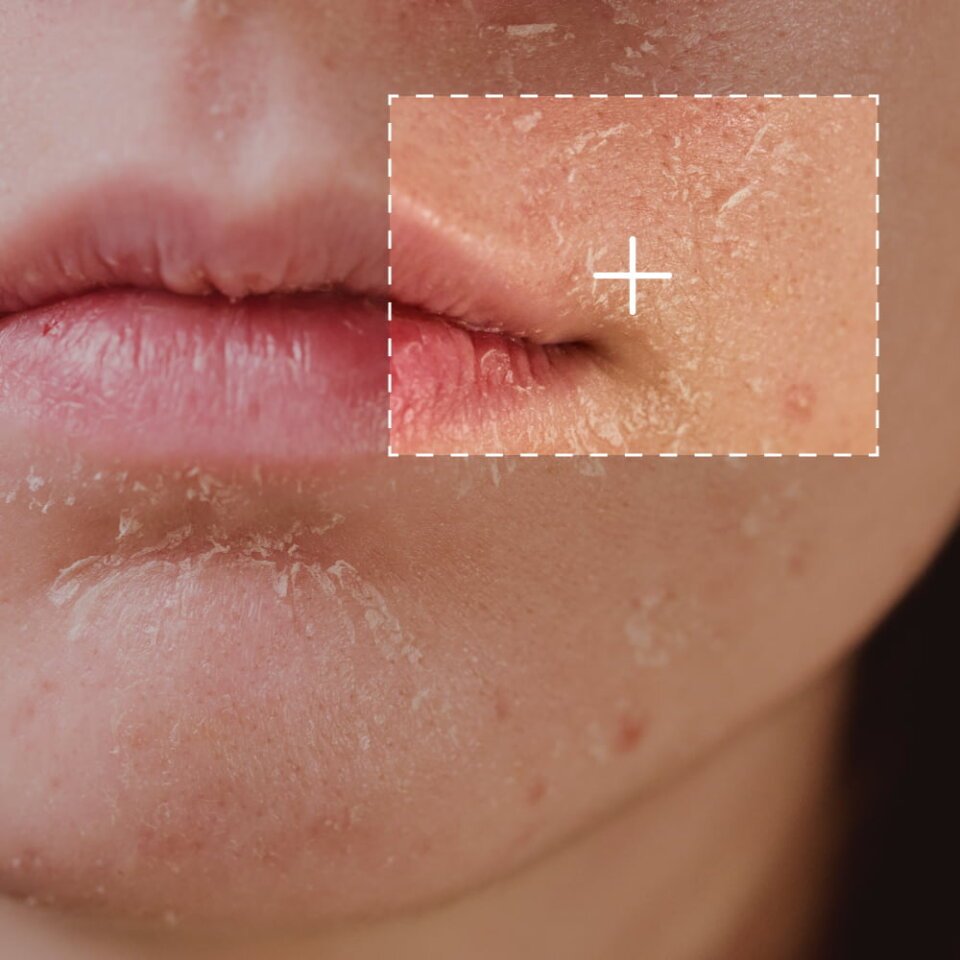 Omnilux Red Light Face Mask image